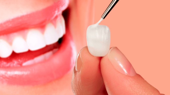 Odontologia Estética | CWB Sorriso
